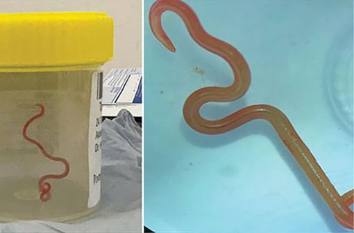 Das undatiertes Bild zeigt einen lebenden Spulwurm „Ophidascaris robertsi“, der im Gehirn einer 64-jährigen Australierin gefunden wurde. In einem Krankenhaus in Canberra haben Ärzte einen lebendigen, acht Zentimeter langen Rundwurm aus dem Gehirn einer 64-jährigen Frau entfernt. Foto: Emerging Infectious Diseases/AP/dpa