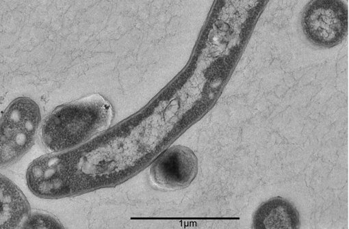 Der Tuberkulose-Erreger Mycobacterium tuberculosis. Foto: Robert Koch Institut/dpa