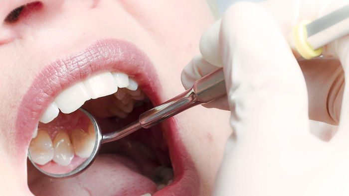 Tipps von Experten: So bleiben die Zähne gesund