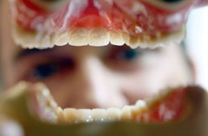Ein Zahnarzt betrachtet eine Zahnprothese.(Symbolfoto) Foto: dpa/Oliver Berg