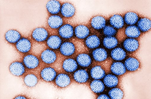 Die Ärzte halten Rotaviren als Auslöser für die Krankheitsfälle für wahrscheinlich. Foto: dpa