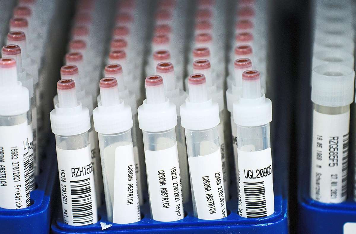 Kunststoffröhrchen mit Corona-Abstrichen nach dem PCR-Test: In entsprechenden Laboren sind solche Proben seit einiger Zeit massenhaft zu finden – allerdings nicht ganz so viele aus dem Kreis Calw, wie eine Meldung es erscheinen ließ. Foto: Arnold/dpa