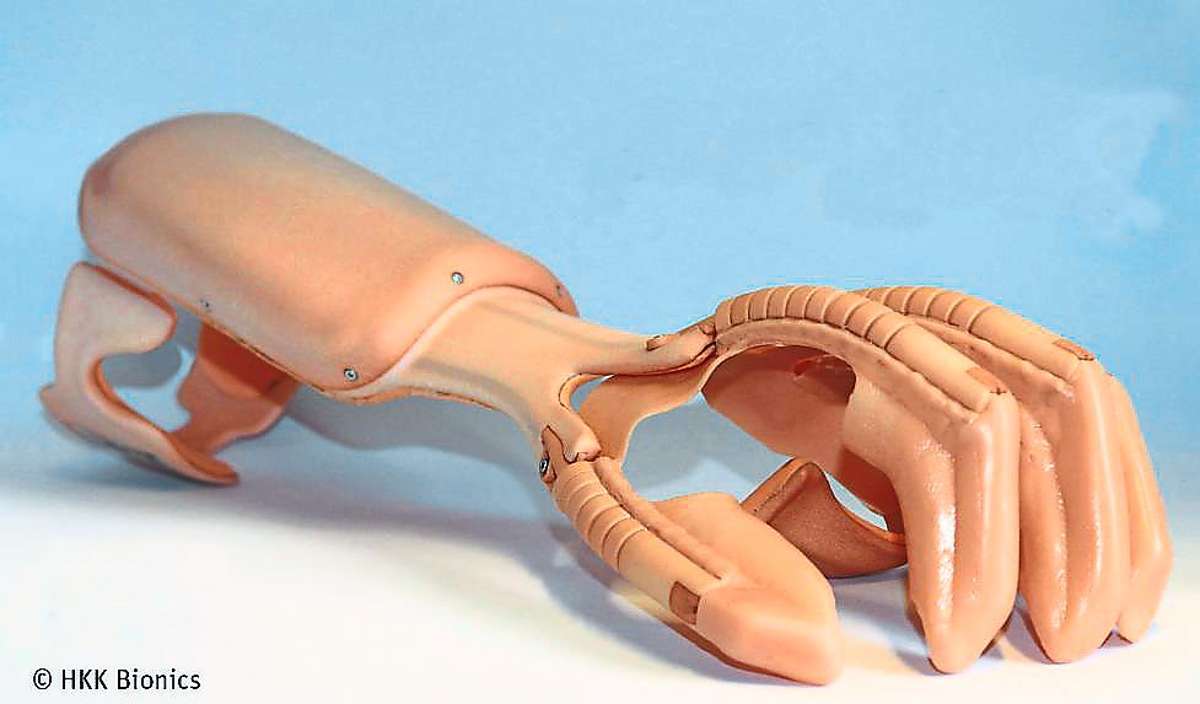 Diese neu entwickelte Hand-Orthese von HKK Bionics wird mit einer Batterie von Jauch Quartz betrieben.Foto: HKK Bionics
