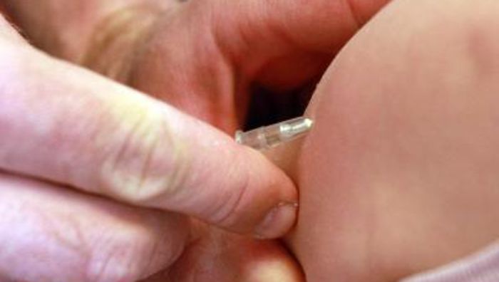 Die Masern kommen: Impfpflicht sinnvoll?