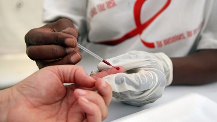 Zehntausende neue HIV-Infektionen