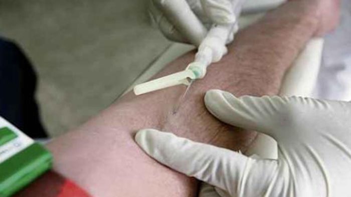 Aids-Hilfe mit kostenlosem HIV-Test