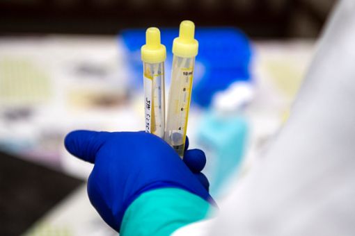 Stolze Zahl: 55 neue Corona-Infektionen hat das Gesundheitsamt am Mittwoch bestätigt. Foto: Taneèek