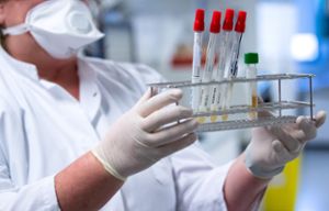 Eine Mitarbeiterin eines virologischen Instituts bereitet Proben von Menschen mit Covid-19 Verdacht in einem Labor für die weitere Analyse vor.  Foto: Hoppe