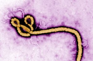 Eine Krankenschwester aus Italien ist mit Ebola infiziert.  Foto: CENTERS FOR DISEASE CONTROL AND
