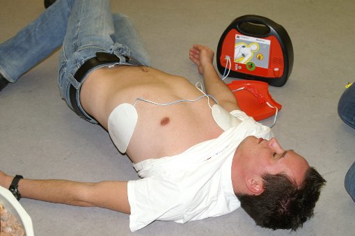 Für Laien kinderleicht zu bedienen, für den Herz-Notfallpatienten unter Umständen überlebenswichtig: Dieses Symbolbild zeigt, wie ein AED richtig angelegt wird. Foto: Gräff