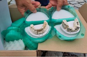 Der Zahnarzt zeigt die Gebissmodelle des Patienten. Rechts die  Implantate mit Aufbauelement, die ein Kollege  gesetzt hatte. Links der Kronenaufbau. Foto: Jürgen Lück