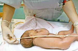 Fast jede dritte Entbindung in Deutschland ist ein Kaiserschnitt. Medizinisch notwendig wären nur zehn bis fünfzehn Prozent, meint die Weltgesundheitsorganisation. Foto: dpa-Zentralbild