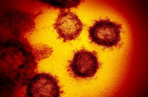 Die vom amerikanischen National Institute of Allergy and Infectious Diseases zur Verfügung gestellte Elektronenmikroskopaufnahme zeigt das Coronavirus SARS-CoV-2. Foto: N/aid-Rml/National Institute of Allergy and Infectious Diseases/dpa